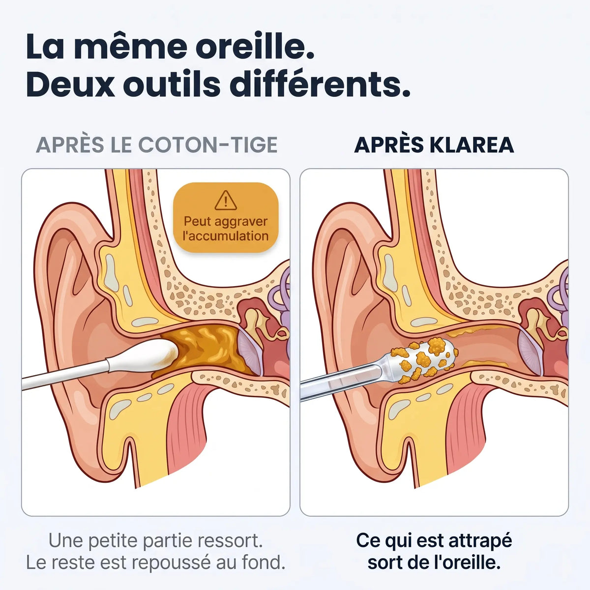 Ohriva™ – Pour une sensation de propreté réelle dans l’oreille